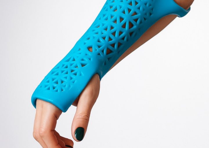 Custom Splints Simplify Daily Healing