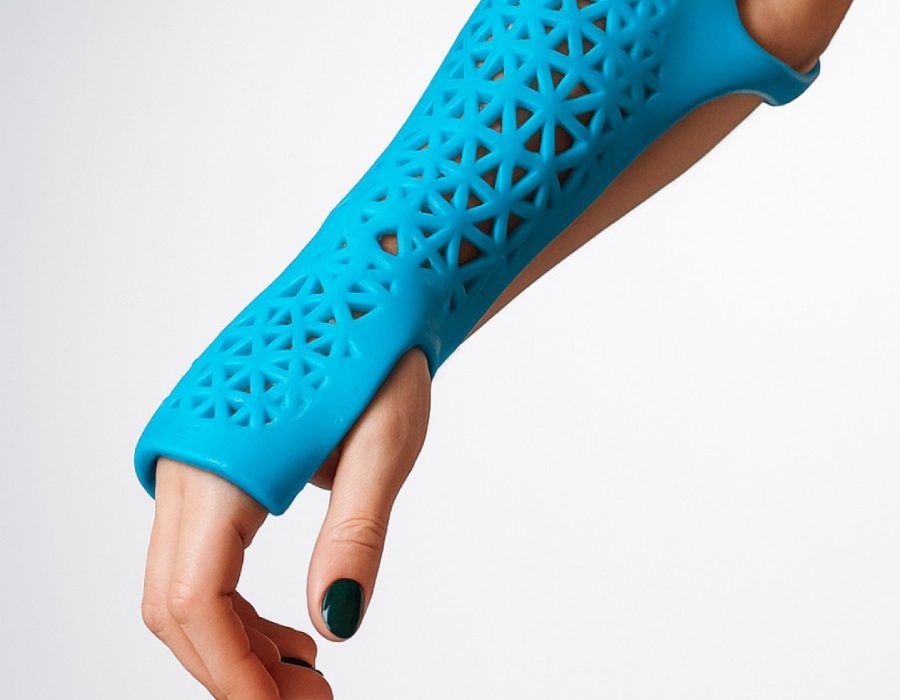 Custom Splints Simplify Daily Healing