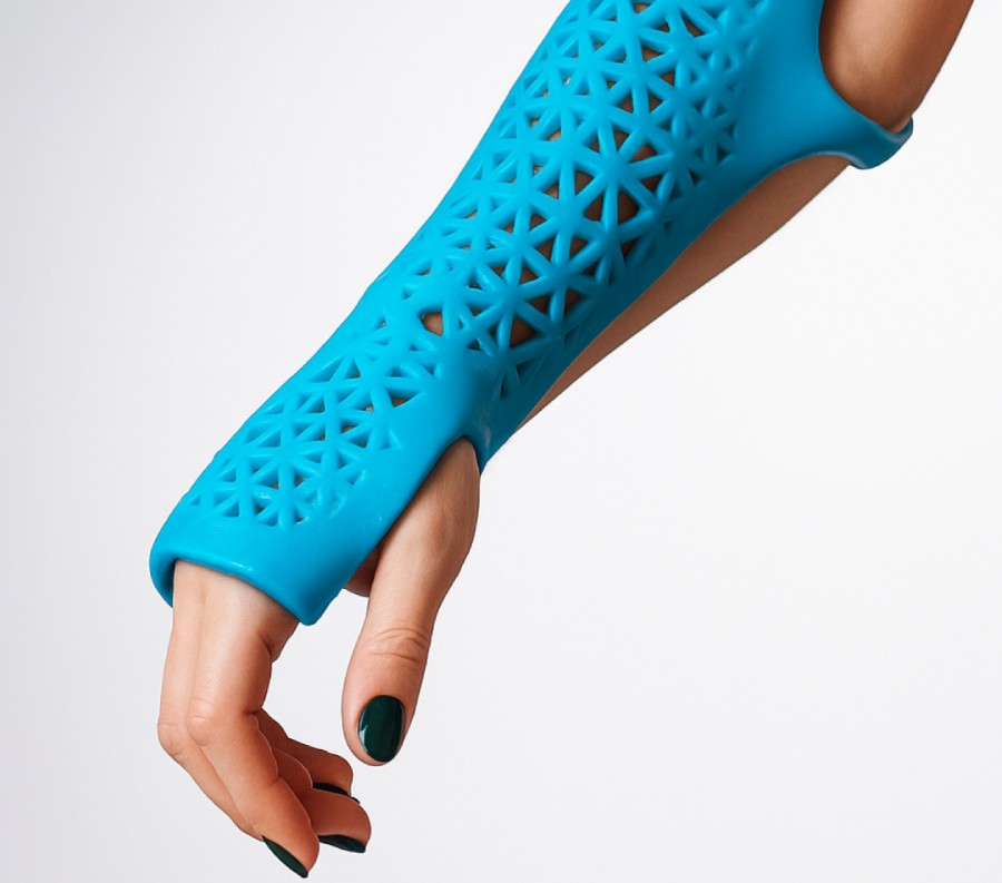 Custom Splints Simplify Daily Healing